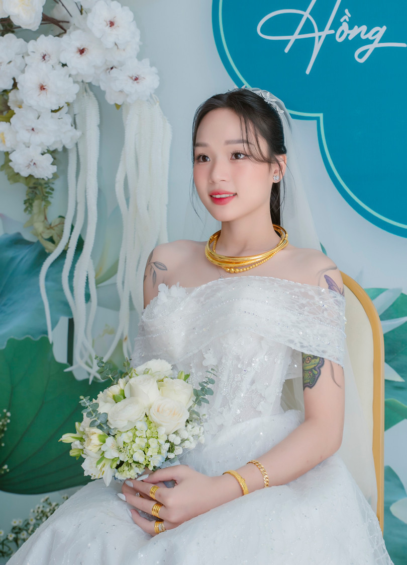 Nhung được bố mẹ bế đi bệnh viện ngay sau đó. Qua nhiều lần thăm khám, bác sĩ kết luận cô bị viêm tủy cắt ngang, liệt hoàn toàn từ rốn trở xuống, không thể đi tiểu chủ động. Đôi chân của cô co rút và teo đi từng ngày.