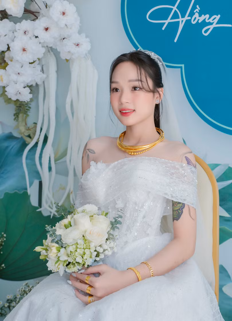 Nhung được bố mẹ bế đi bệnh viện ngay sau đó. Qua nhiều lần thăm khám, bác sĩ kết luận cô bị viêm tủy cắt ngang, liệt hoàn toàn từ rốn trở xuống, không thể đi tiểu chủ động. Đôi chân của cô co rút và teo đi từng ngày.