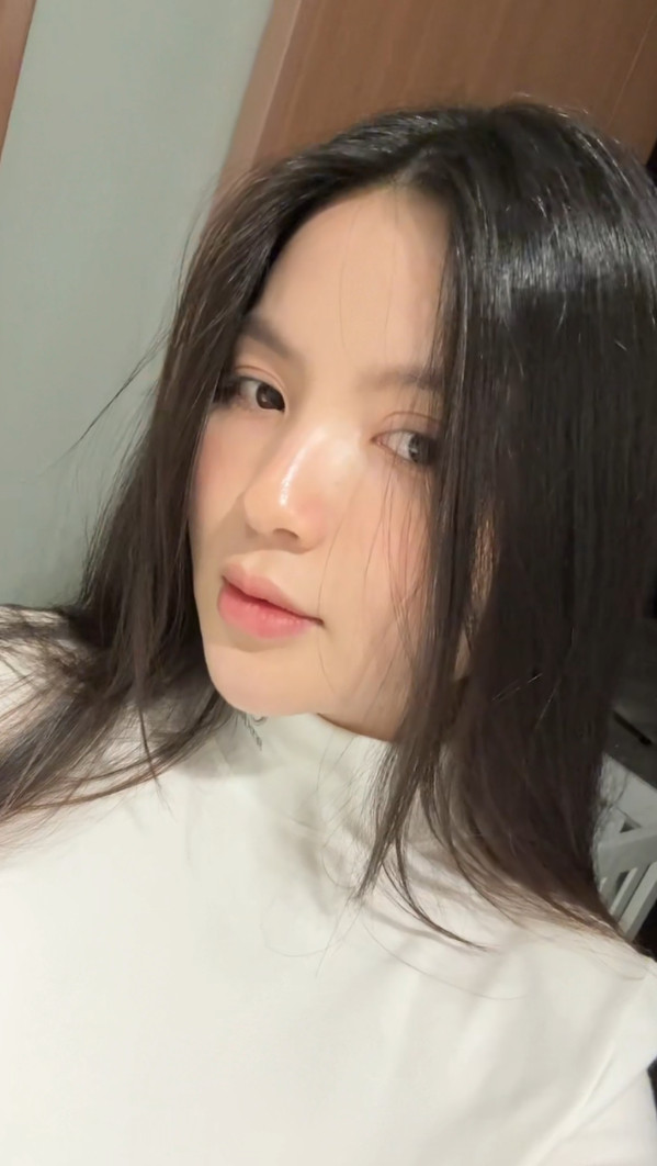 Bà xã Quang Hải chia sẻ "Các chị em nhìn ngang sẽ thấy môi của em hơi trề ra. Tại filter để lâu nên nó hơi bị trề ra như vậy". Quyết định đi tiêm tan môi này của Chu Thanh Huyền cũng được chính ông xã Quang Hải gợi ý và ủng hộ. (Ảnh: FBNV)