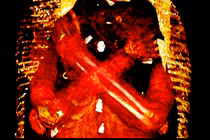 "Nội soi" xác ướp Ai Cập, bàng hoàng thấy 49 lá bùa hộ mệnh