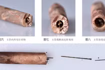 Bất ngờ phát hiện kim châm cứu bằng thép cổ nhất thế giới 