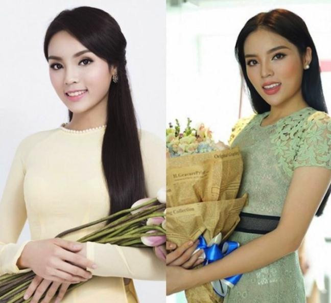 Tuy nhiên lời giải thích này không thuyết phục được khán giả. Nhiều người vẫn cho rằng cô vừa tiêm botox và chất này chưa kịp tan, khiến gương mặt mỹ nhân 9x cứng đờ và sưng phồng. Hiện Kỳ Duyên vẫn chưa lên tiếng về ồn ào này.