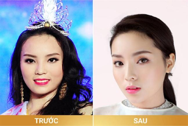 Đại diện trung tâm thẩm mỹ cho biết Kỳ Duyên đã sử dụng dịch vụ của mình còn Hoa hậu lại tiếp tục khẳng định gương mặt thay đổi là nhờ bấm huyệt.