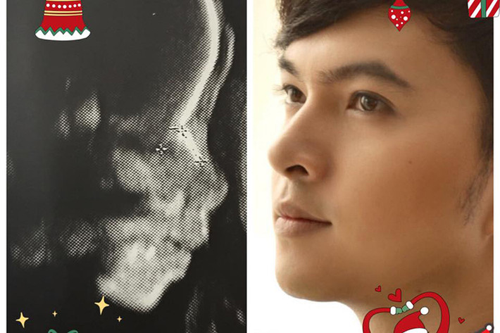 Giọng ca “Bay giữa ngân hà” khoe hình ảnh siêu âm con đầu lòng và khẳng định bé rất giống bố. Ảnh: FBNV