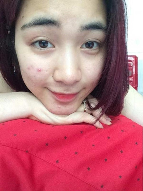 Hòa Minzy sở hữu gương mặt ưa nhìn. Trong một thời gian khá dài, cô khổ sở vì làn da nhạy cảm, nổi mụn. Giọng ca Rời bỏ đã cải thiện làn da bằng mỹ phẩm, chế độ ăn uống, chăm sóc da. Ảnh: Dân Việt.