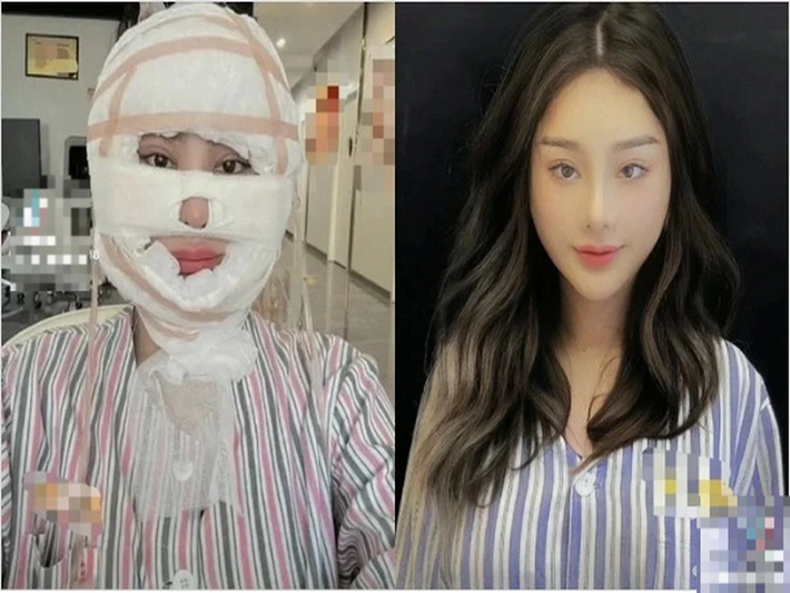 Lâm Khánh Chi phẫu thuật thẩm mỹ cách đây ít ngày. Nữ ca sĩ được cho là căng da mặt tại Trung Quốc. Ảnh: Dân Trí.