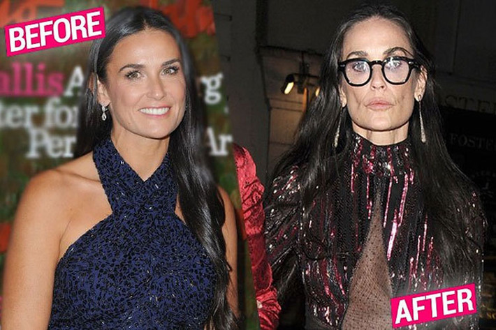 Giống Jennifer Garner, Angelina Jolie và Gwen Stefani, Demi Moore đã trải qua cuộc hôn nhân thất bại nhưng cô lại ngày càng thảm hại. Ảnh: Tiền phong