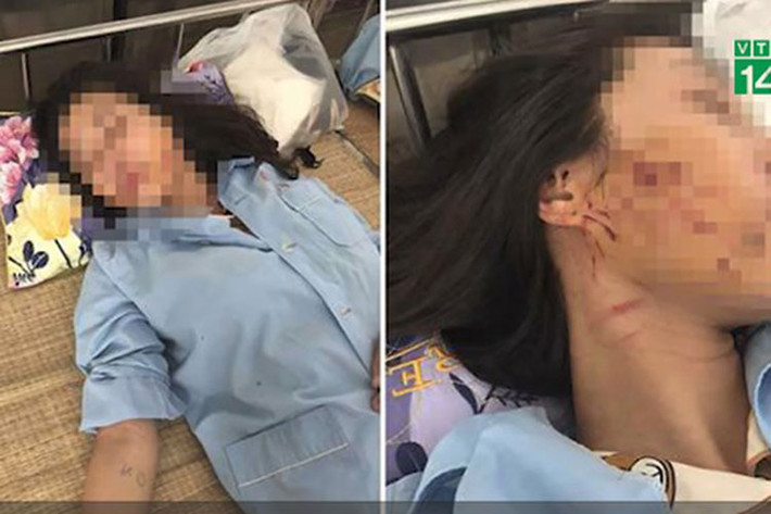 Vào cuộc điều tra, CQĐT Công an TP Thanh Hóa đã triệu tập 4 đối tượng liên quan, sau đó đã tiến hành khởi tố bị can đối với 3 người gồm: Nguyễn Thị Hoa (42 tuổi, trú ở phố Bến Ngự, phường Trường Thi); Nguyễn Thuỳ Linh (26 tuổi) và Phạm Thị Thuỳ Dung (27 tuổi) cùng trú tại phường Đông Hương, TP Thanh Hoá để điều tra hành vi làm nhục người khác. Trong ảnh, chị G lúc điều trị ở bệnh viện. (Ảnh: VTC 14)