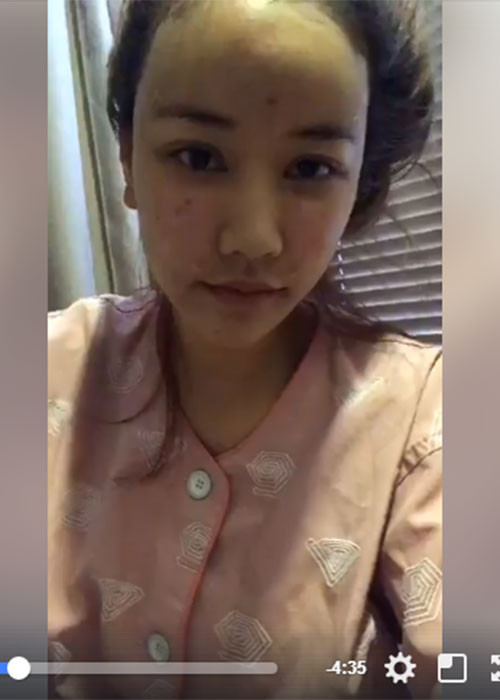 Hot Face sao Việt 24h: Vừa trải qua ca phẫu thuật cấy mỡ và tế bào da lên mặt, Maya không ngần ngại chia sẻ hình ảnh gương mặt sưng phù.