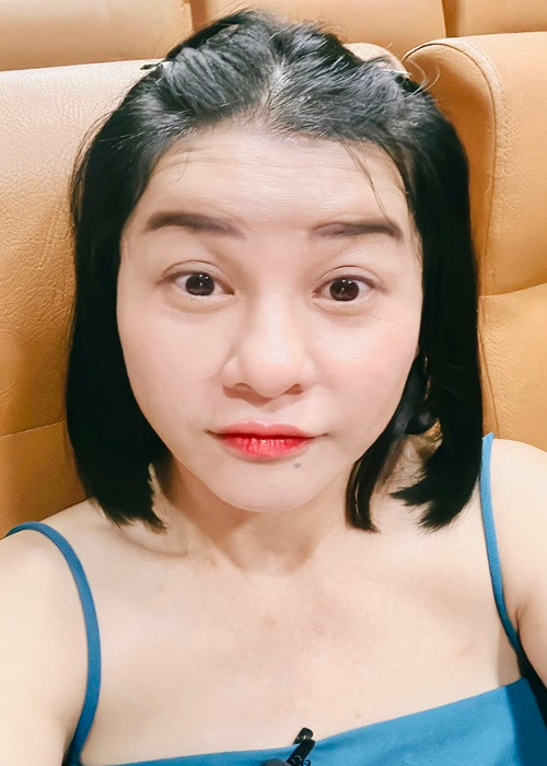 “Thương em Việt Hương, ngồi chờ chị Cát cắt mí xong, vào xem tận mắt rồi mới chịu. Bác sĩ canh rất khó vì mắt Cát bên lớn bên nhỏ, da không nhiều, mỡ mắt cũng không nhiều. Bác sĩ phải làm kỹ nếu không mắt sẽ rất dễ bị trợn”, Cát Phượng chia sẻ.