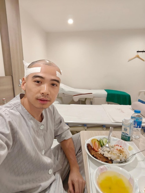 "Anh Khôi lên bàn mổ lấy nang tóc sau gáy và bắn cấy lên mặt trước của đầu rồi cả nhà ạ. Em Hen cản dữ lắm tại thấy anh đẹp lắm rồi. Nhưng anh quyết tâm quá, nên chúc anh vạn sự bình an, cấy tóc an toàn và đúng ý ảnh muốn. Ca này thực hiện khoảng 8-10 tiếng nên mọi người không liên lạc được ảnh đừng quá lo lắng nhé", Hoa hậu H'hen Niê chia sẻ về việc tân trang vẻ ngoài của Tuấn Khôi. Ảnh: FB Tuấn Khôi.