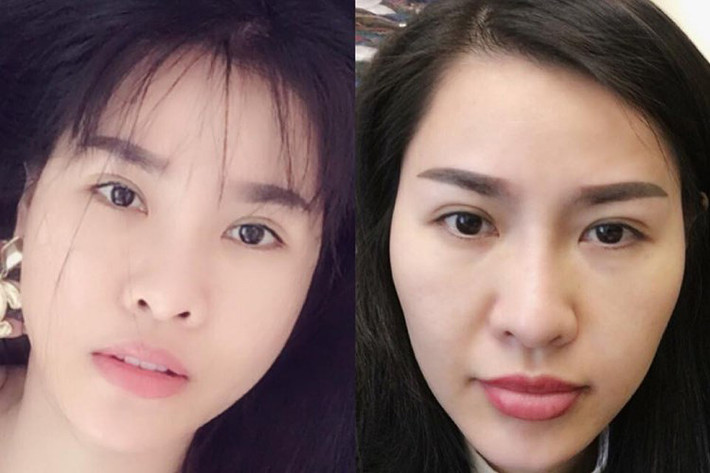 Quế Vân vốn không hài lòng với gương mặt cũ của mình. Bởi vậy, vào khoảng tháng 4 vừa qua, cô phẫu thuật thẩm mỹ thay đổi hoàn toàn gương mặt. Sau hơn 1 tháng, cô mới công khai ảnh "đập mặt làm lại". Ảnh: FBNV
