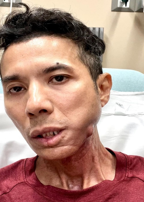 Hơn tháng qua, Kasim Hoàng Vũ đau đớn, đêm nào cũng thức đến sáng. Ảnh: Vietnamnet.