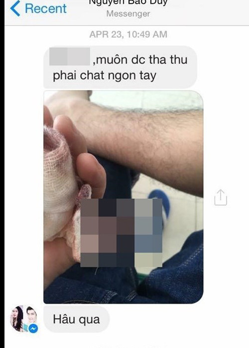 Sau khi Bảo Duy và Phi Thanh Vân kết hôn, dư luận từng hoảng hồn trước thông tin Bảo Duy chặt ngón tay út để xin lỗi vợ. Theo đó, một tài khoản Facebook đăng ảnh ngón tay út đầy máu của Bảo Duy. Điều này trùng khớp với hình ảnh anh băng bó ngón tay út trong chuyến từ thiện cùng Phi Thanh Vân. (Ảnh: Một thế giới)