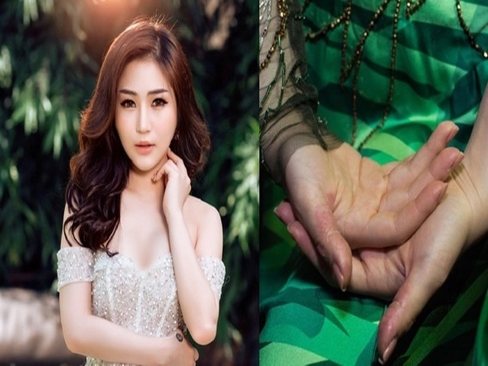 Không chỉ Phương Mỹ Chi bị stress, vì áp lực khi hoạt động trong showbiz, nhiều sao Việt cũng rơi vào tình trạng tương tự. Hương Tràm là một trong số đó. Năm 2018, Hương Tràm liên tục mất ngủ do căng thẳng nên tự bóc da tay đến mức chảy máu. Theo các bác sĩ, Hương Tràm có thể mắc một trong những biểu hiện của Hội chứng tự ngược đãi bản thân. Ảnh: Vietnamnet