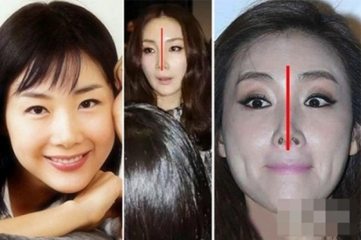 Người đẹp bị cư dân mạng Hàn soi nhiều nhất với nghi vấn “dao kéo” vùng mũi chính là Choi Ji Woo. 3 bức hình đặt cạnh nhau đã chỉ rõ phần mũi bị biến dạng, hai bên không đều nhau, khác hẳn với hình ảnh trong quá khứ (trái)