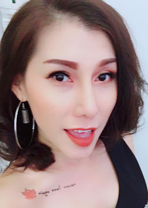 Sau 7 năm nâng ngực, Ivy Trần bị nổ túi ngực. Sự cố khiến nữ ca sĩ phải tháo túi ngực. Ảnh: FBNV