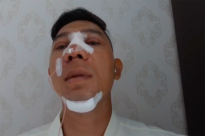 Lương Bằng Quang nâng mí, sửa mũi, độn cằm. Theo nam ca sĩ, anh dao kéo để bản thân cảm thấy hài lòng với mình hơn. Ảnh: Lao động