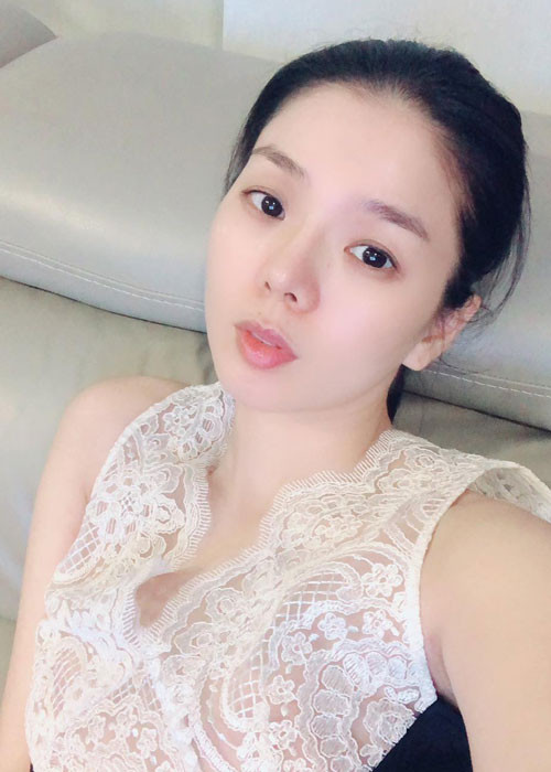Vì sụn mũi đã gắn quá lâu và dính liền vào mũi nên quá trình tháo sụn mũi của Lệ Quyên khá khó khăn.