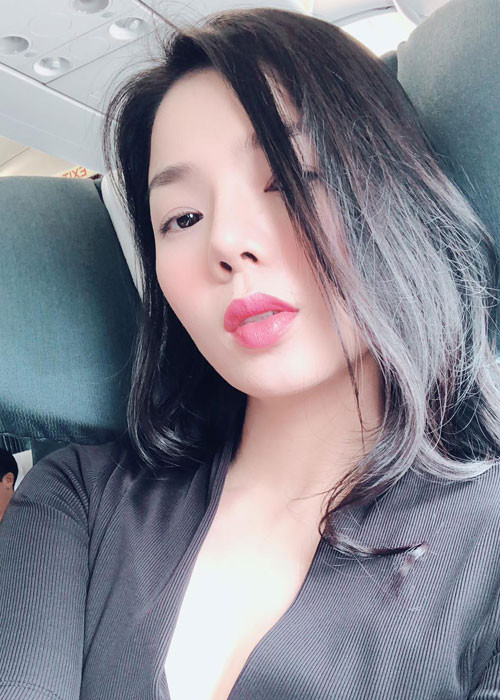 Hình ảnh chiếc mũi cao nhờ dao kéo của Lệ Quyên trước khi bị sưng nặng.