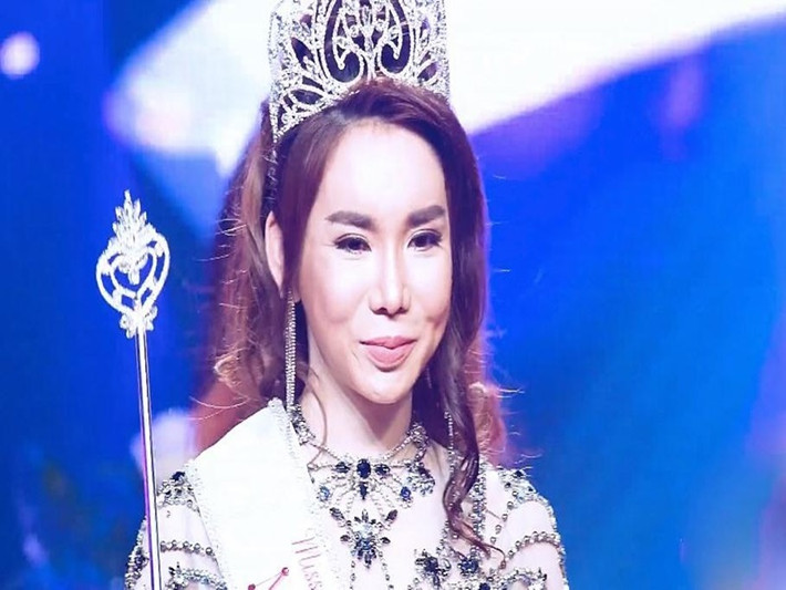 Nhan sắc của Lã Kỳ Anh lên xuống thất thường. Khi đăng quang, chân dài lộ gương mặt cứng đờ, thiếu tự nhiên. Ảnh: Yan