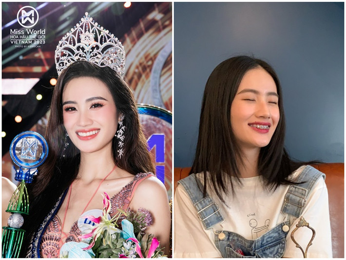 Huỳnh Trần Ý Nhi là một trong những mỹ nhân Việt thăng hạng nhan sắc một phần nhờ niềng răng. Ảnh: FBNV, Miss World Vietnam.