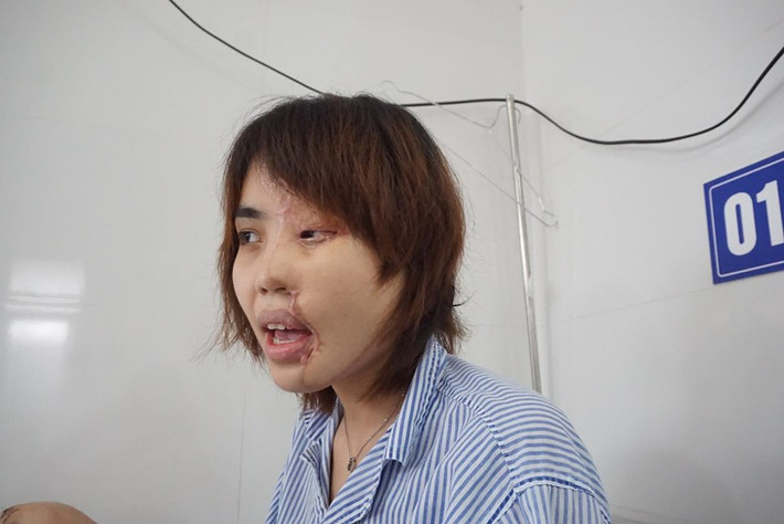 Bố Vy cho biết, con gái qua cơn nguy kịch là mừng lắm rồi. Nhưng thực sự đau lòng khi sự việc xảy ra.