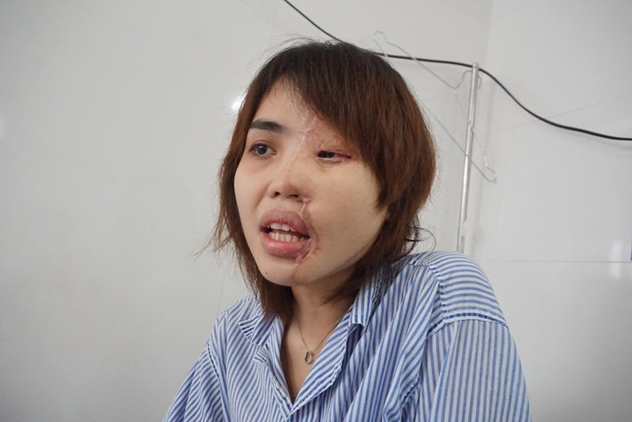 Nhìn Vy, ai biết chuyện cũng xót thương cho cô gái.