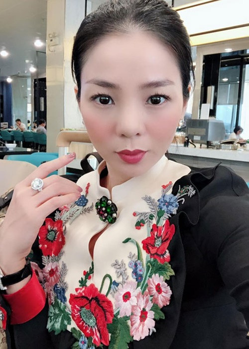 Gương mặt của Lệ Quyên bớt sưng sau khi tháo sụn mũi. Ảnh: FBNV