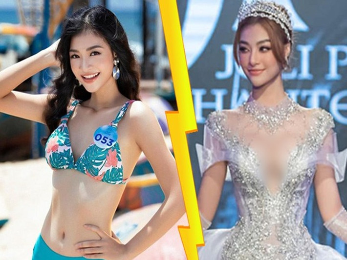 Kiều Loan tìm đến bác sĩ để phẫu thuật thẩm mỹ mặc dù bị gia đình phản đối. Sau khi dao kéo, cô tự tin hơn. Ảnh: Sức khỏe và đời sống