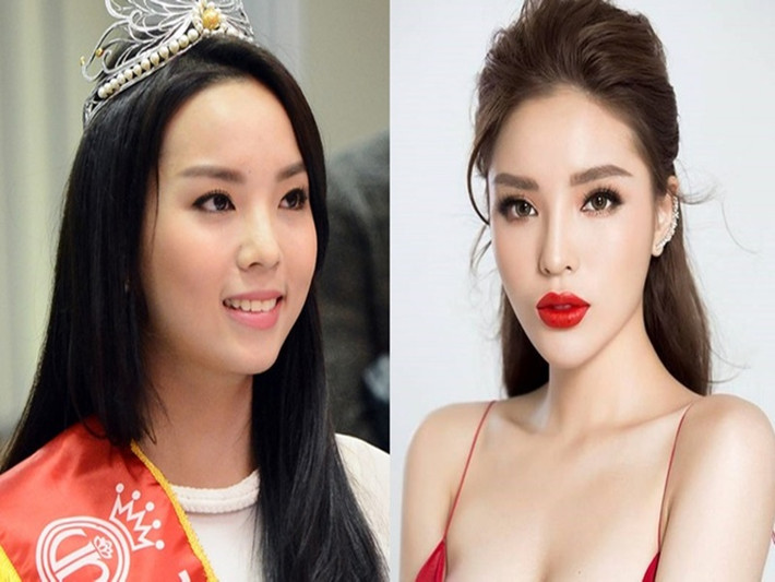Chiếc cằm nhọn, đôi môi dày khiến Hoa hậu Kỳ Duyên vướng nghi vấn dao kéo. Ảnh: Zing