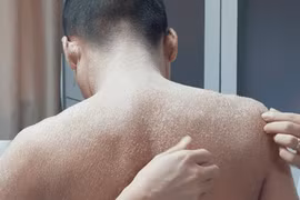 Cha mẹ kết hôn cận huyết khiến con trai bị khiếm khuyết di truyền đáng sợ