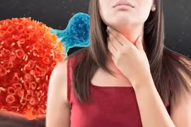 Dấu hiệu ung thư thực quản dễ nhầm với bệnh khác 