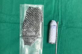 Gallery - Giới tính thứ 3 - image 2
