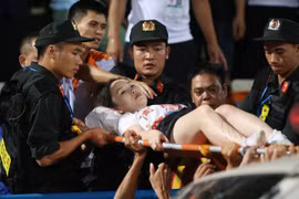 Gallery - Fan nữ trúng pháo sáng CĐV Nam Định - image 2