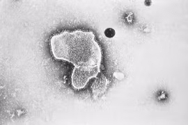 Virus hợp bào hô hấp gây bệnh ở trẻ nguy hiểm sao?