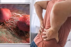 Những dấu hiệu của ung thư tuyến tiền liệt