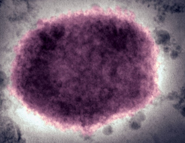 Bùng phát virus hiếm gặp và bất thường tại Anh Bung phat virus hiem gap va bat thuong tai Anh