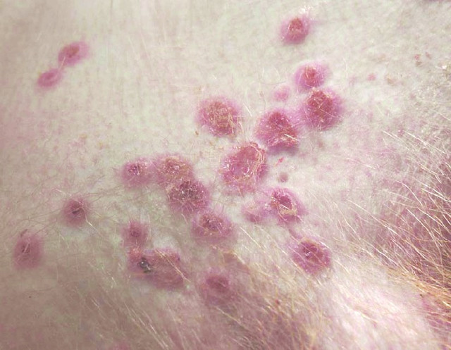 Bùng phát virus hiếm gặp và bất thường tại Anh - Hình 2 Bung phat virus hiem gap va bat thuong tai Anh-Hinh-2