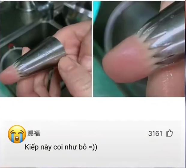 Thanh niên suýt mất ngón tay chỉ vì nghịch ngợm khi làm bánh - Hình 2 Thanh nien suyt mat ngon tay chi vi nghich ngom khi lam banh-Hinh-2