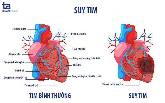 Căn bệnh nào đã mang nhạc sĩ Ngọc Châu ra đi sớm? - Hình 2 Can benh nao da mang nhac si Ngoc Chau ra di som?-Hinh-2