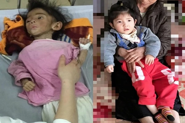 9X nhận nuôi bé bại não ở Lào Cai giờ ra sao?