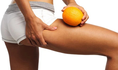 6 thực phẩm khiến bạn bị da sần vỏ cam xấu tệ