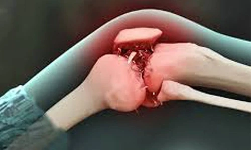 Nhận dạng các loại ung thư đáng sợ dễ tấn công trẻ