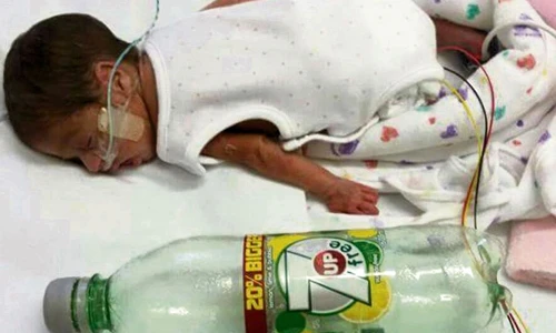 Sức sống kì diệu khó tin của bé gái lớn bằng chai 7up