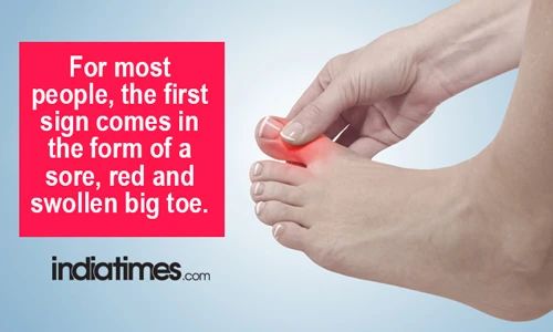 Nhìn, sờ bàn chân, nhận ra ngay các dấu hiệu bệnh tật