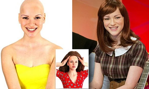 Cảm phục thiếu nữ gọt đầu ủng hộ bệnh nhân ung thư