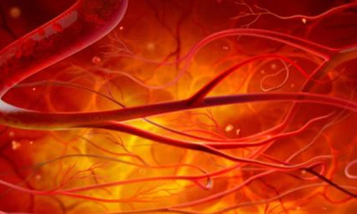 Lưu ý chi tiết giúp ngăn ngừa thiếu máu não