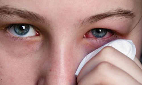 Những yếu tố hàng đầu gây ung thư mắt