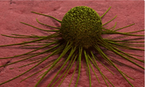 Cận cảnh sự tấn công của tế bào ung thư miệng